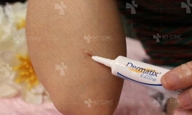 Hiệu quả kem trị sẹo Dermatix khá tốt đối với các vết sẹo nhỏ trên cơ thể